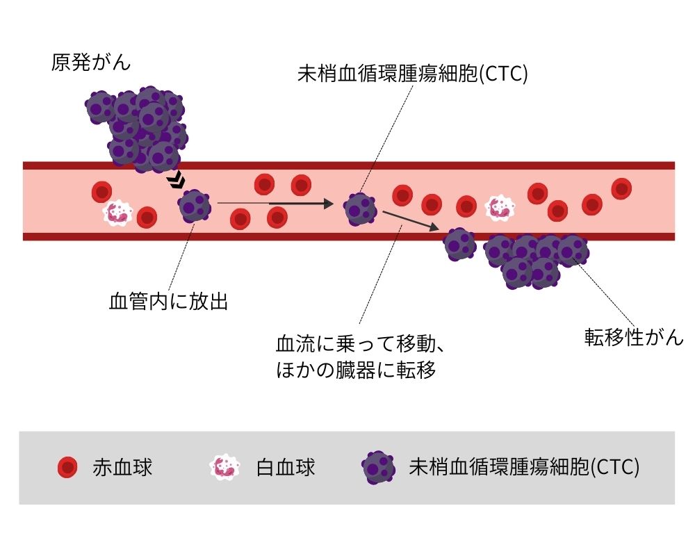 CTC検査とは